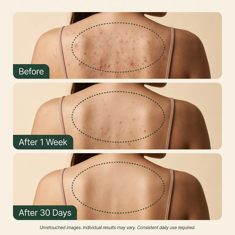 Calluve Tea Tree Body Clear Set
