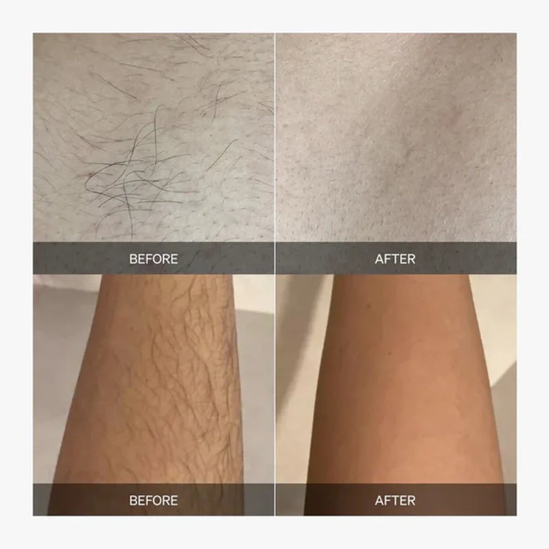 Calluve 2-in-1 Ingrown Free Bikini Shaver