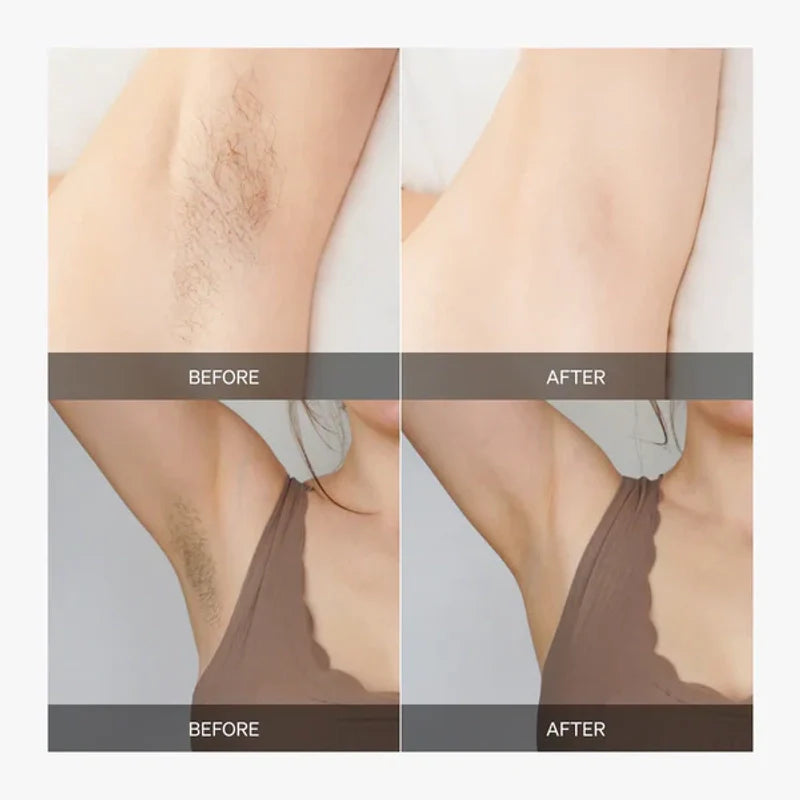Calluve 2-in-1 Ingrown Free Bikini Shaver