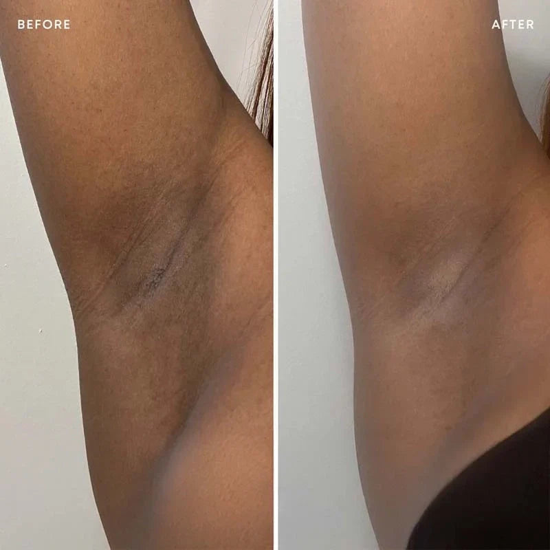 Calluve Turmeric + Kojic Acid Brightening Deodorant