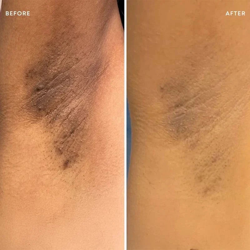 Calluve Turmeric + Kojic Acid Brightening Deodorant